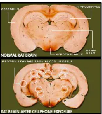 Figura 5 - Comparação entre seções histológicas do cérebro dos ratos (com e sem radiação)