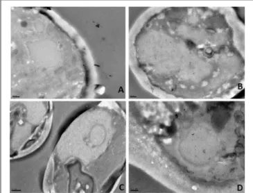 FIGURE 8 | Immunogold localization in C. albicans after incubation with the BCO for (A) 2 h, (B) 6 h, (C)12 h and (D) 24 h, as observed by TEM