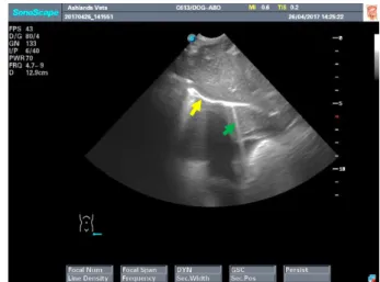Figure 1 DH view site for an AFAST or TFAST exam.  Figure  2  DH  view  during  AFAST  or  TFAST  scan