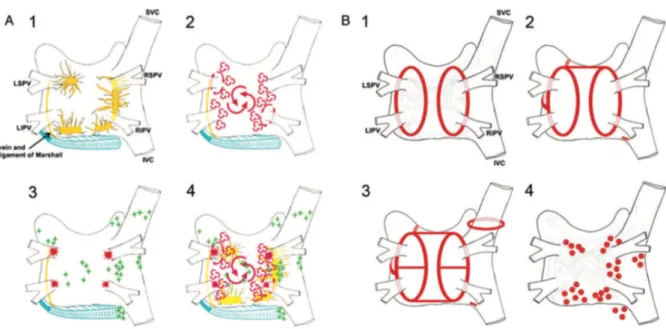 Figura 1: A. Estrutura básica da fibrilhação auricular (FA). (1) Visão posterior da extensão das fibras musculares  auriculares  até  às  veias  pulmonares  (VP)