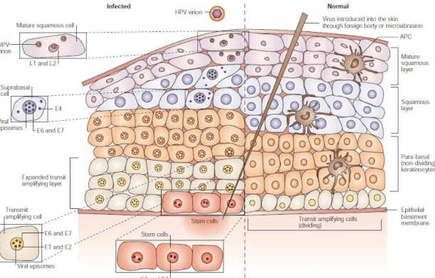Figure 4. Evolution of infection by HPV [48]. 