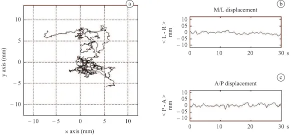 Figure 1. COP displacement in the statokinesiogram (a) and both M/L (b) and A/P (c) direction.