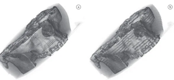 Figure 1. 3D visualization using linear interpolation. a) Using 26 slices with a space of 2 mm between them; b) using 13 slices with a space  of 4 mm between them.