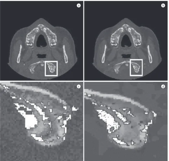Figure 3 illustrates the virtual slices obtained with  and without the diffusion step