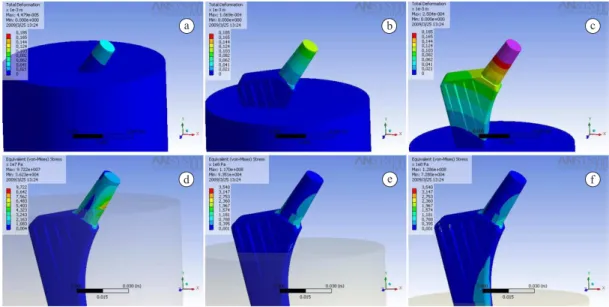 Figure 6. Example of numerical results in terms of total deformations (a, b, c) and Von Mises Equivalent Stress (d, e, f) for the three conditions  evaluated (only neck exposed, partially exposed ins, and fully exposed ins) for 1200 N.