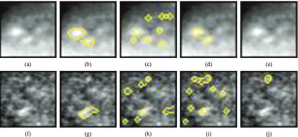 Figure 4. Examples of original ROIs (a) and (f) for which both radiologists considered segmentation to be inadequate