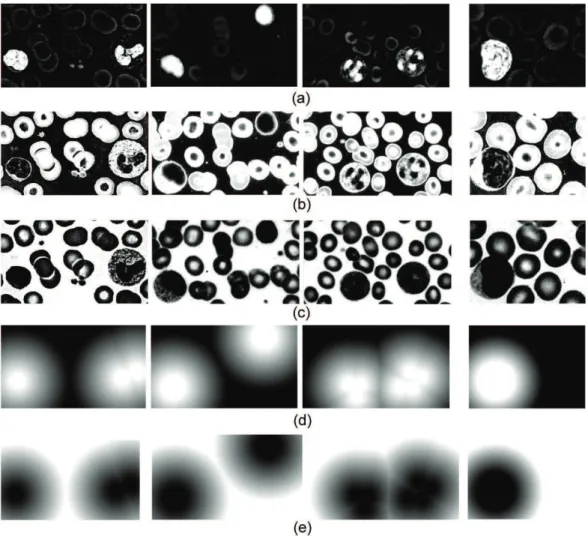 Figure 3.  Fuzziication process (left to right, samples stained with Fast Panoptic, Leishman, Rosenfeld and unspeciied staining): a) fuzziication  of dark tonality; b) fuzziication of medium tonality; c) fuzziication of light tonality; d) fuzziication of h