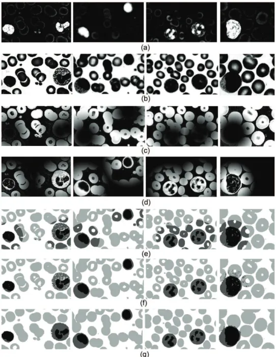 Figure 4.  Membership rules and post-processing (left to right, samples stained with Fast Panoptic, Leishman, Rosenfeld and unspeciied  staining): a) membership rule 1 – leukocyte nucleus class; b) membership rule 2 – blood plasma class; c) membership rule