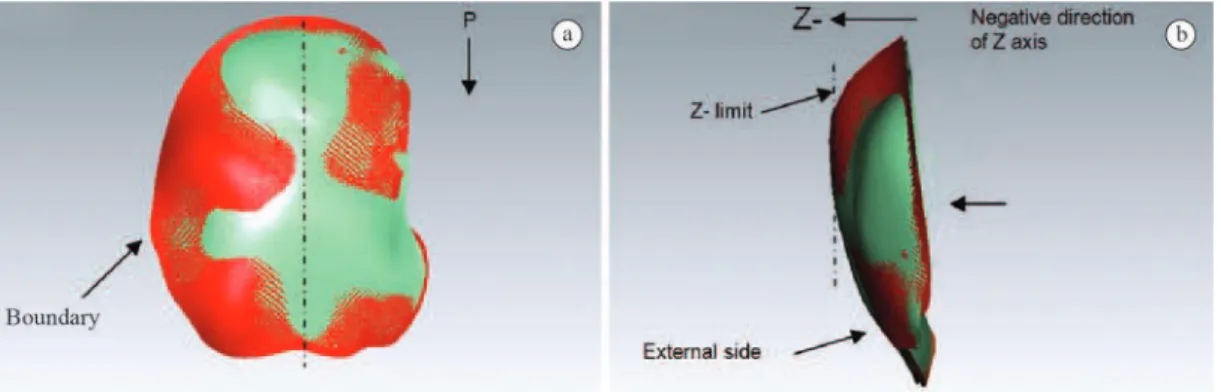 Figure 5. Dimensional analysis between the CAD model (red) and scanned formed implant (green)