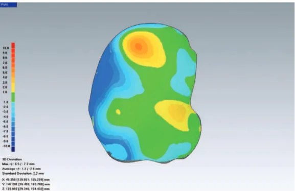 Figure 6. Dimensional analysis. The colors indicate the differences between the reference (CAD Model) and formed implant