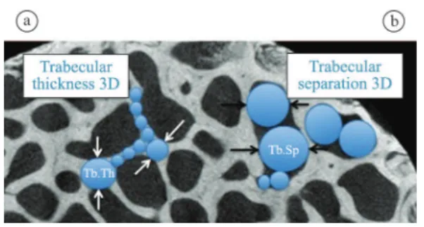 Figure 3. Schematic drawing of the principle of determination (Tb.