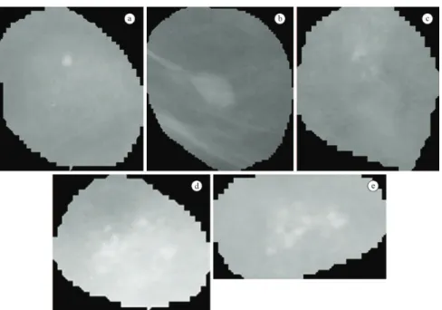 Figure 7.  Benignant ROIs. (a) to (e) correspond to the benignant samples labeled B1 to B5.