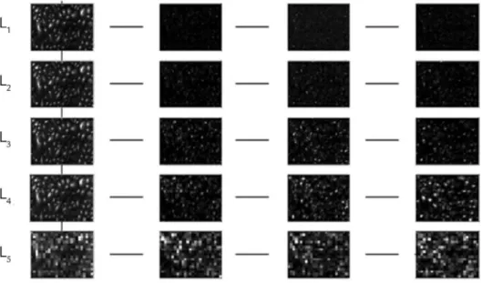 Figure 5 Wavelet decomposition of  normal froth gray image in tree view mode