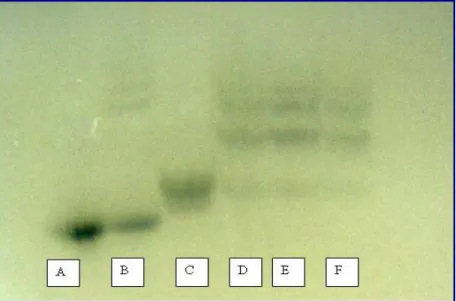 Figura 10: Foto de gel de amido com padrões típicos da migração de haptoglobina, onde: 