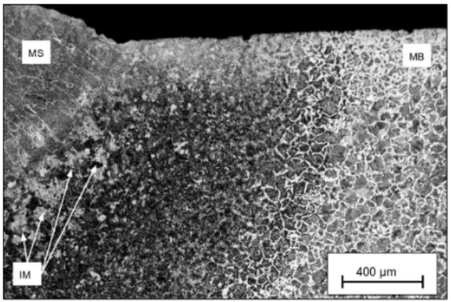 Figura 7. Micrografia mostrando desde o metal de solda (MS) até o metal base (MB) e indicando a região de  formação das ilhas de martensita (IM)