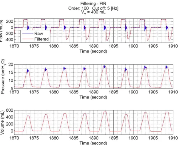 Figure 2 shows a sample of data randomly  chosen before and after iltering. The chosen ilter  was a 100-order FIR ilter