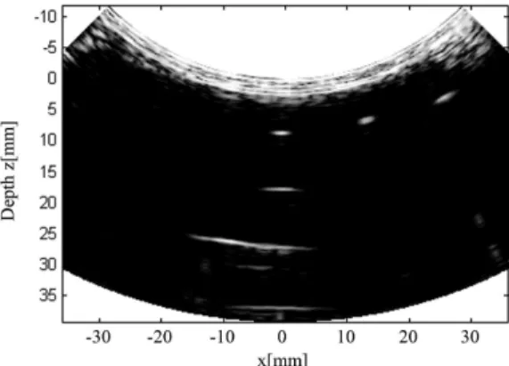 Figure 3. Normalized radio-frequency echo signals acquired from  individual elements of the 128-element convex array probe.