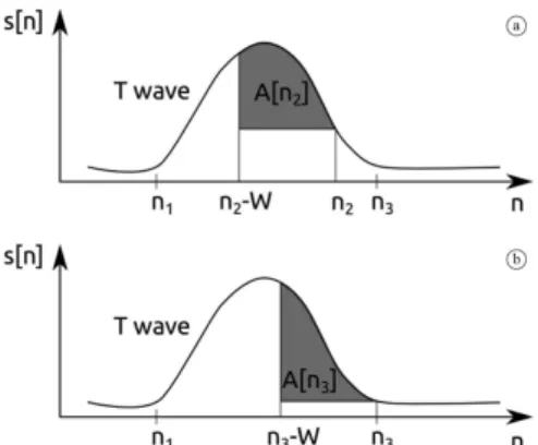 Figure 1. Illustration of Zhang’s method. (a) shows A[n] (the area  between s[n] and the signal from sample n-W to n) decreasing when  the window is left of the correct T wave end point n 3 