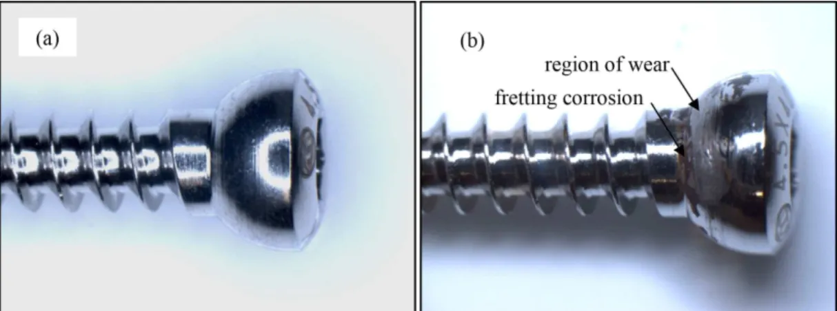 Figure 7 shows the changes in the screw surface  after the fretting corrosion test. Also the adjacent  regions of mechanical wear and corrosion, which  are indicative of the fretting corrosion mechanism,  can be seen.