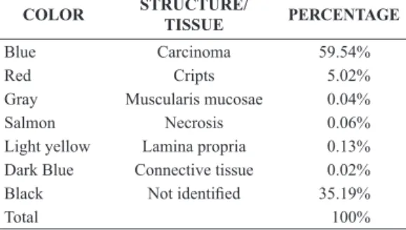 Table 3. Correlation of biochemical versus morphological colon  adenocarcinoma, obtained using routine computational neural networks.