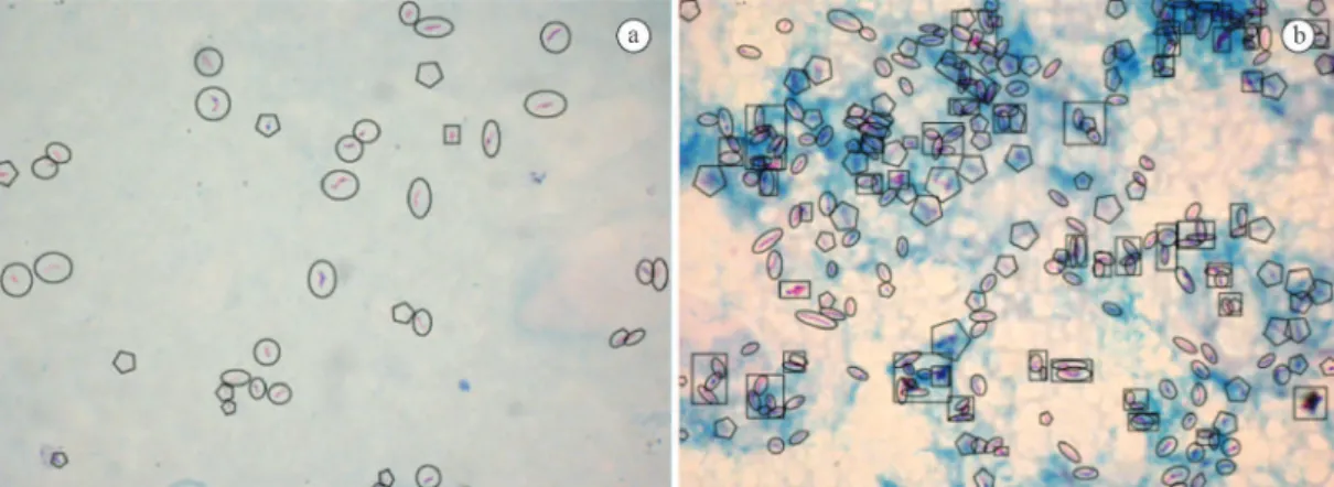 Figure 2. Examples of sputum smear images in which the objects were identiied as: true bacillus - circular or oval shape; doubtful bacillus  – polygon; agglomerated bacilli- rectangle