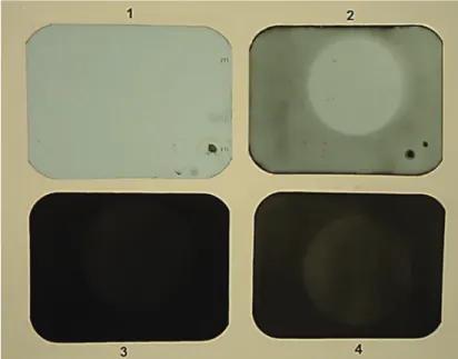 Figure 1  shows the types of images obtained by  the method used in this study; the ODs of the images  ranged from acceptable to very high