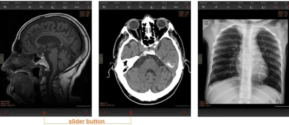 Figure 1.  Examples of the application interface for 3 exams: MRI (left), CT (center) and conventional radiography (right).
