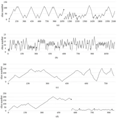 Figure 3. Slice change events during navigation with time equalized. An ascending line indicates the image selector is being slided to the  right; a descending line means a movement to the left