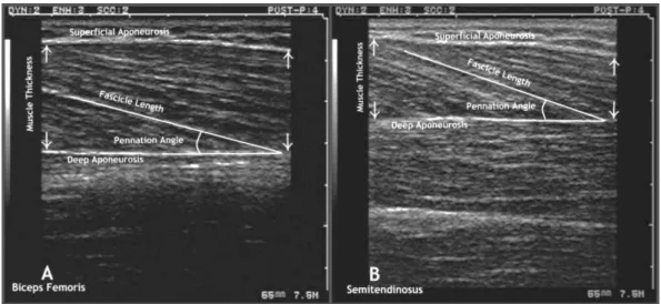 Figure 2. Ultrasound images of muscle thickness, fascicle length and pennation angle measurements of the biceps femoris long head (A) and  semitendinosus (B).