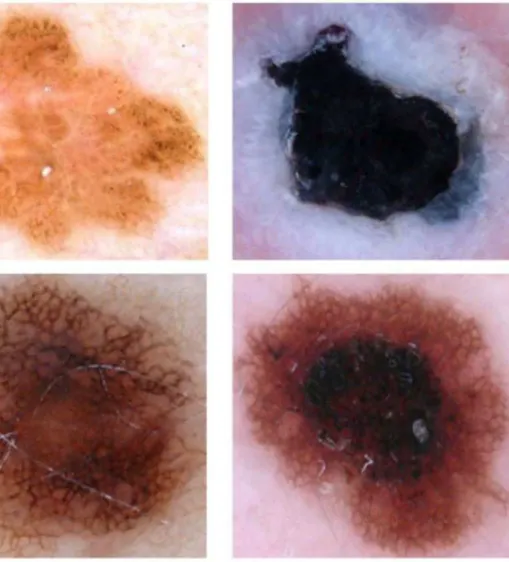 Figure 3. Examples of dermoscopic images with detection error.