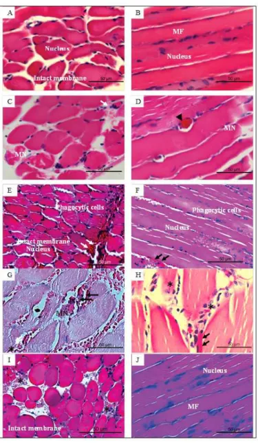 Figure 4. Histological sections of mouse tibial muscle injected with B. jararaca venom (40 µg)