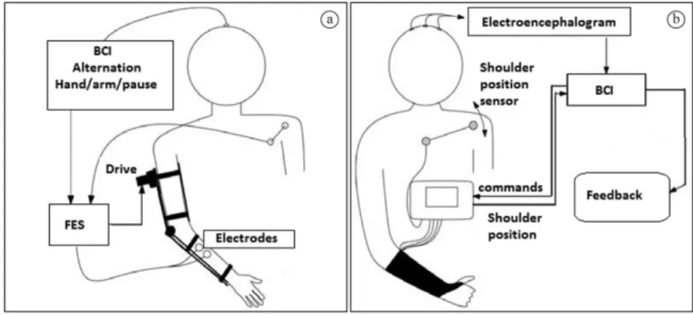 Figure 6. Neuroprosthesis hybrid coniguration scheme (use of FES controlled by a BCI) for users with restricted elbow and hand function  (a) and only on hand (b)