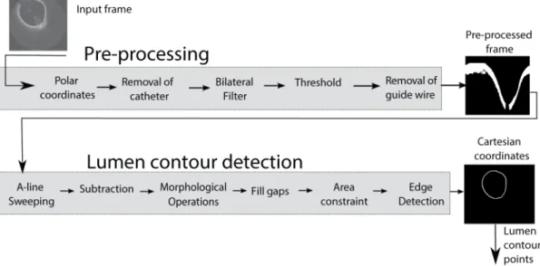 Figure 1. Proposed methodology for automatic obtention of a lumen contour. The proposed methodology receives, as input, each frame from  a whole OCT image set and performs pre-processing to highlight the intima layer, followed by morphological operations a