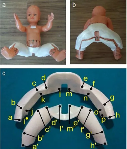 Figure 5. Children’s hip orthosis produced in biodegradable polymer polylactic acid (PLA) by rapid prototyping using fused deposition  modeling: a) Front and b) Down view - The manufacturing process is available in Biomecanica e Forense UNIFESP (2015); c) 