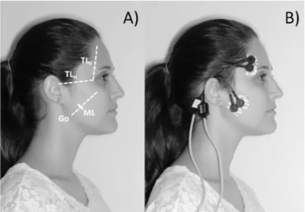 Figure 1. (A) The lateral view of skull shows the reference lines used  in this study: TL V , TL H  and ML