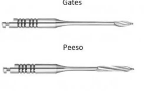 Figura IV - Comparação de Borcas de Peeso e Gates Glidden (Coniglio, et al., 2008) 