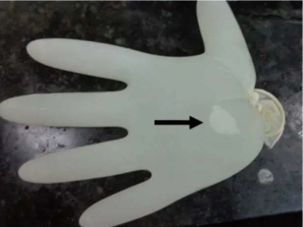 Figure 2. Formation of air bubble cluster, indicated by the arrow, on a  latex glove illed with common tap water