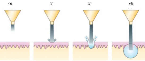 Figura  8  -  Representação  esquemática  da  administração  transcutânea  através  do  jet  injector de formas líquidas