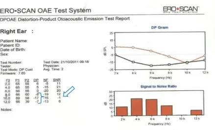 Figura  3  –  Modelo de descrição de resultados do exame de EOAPD 