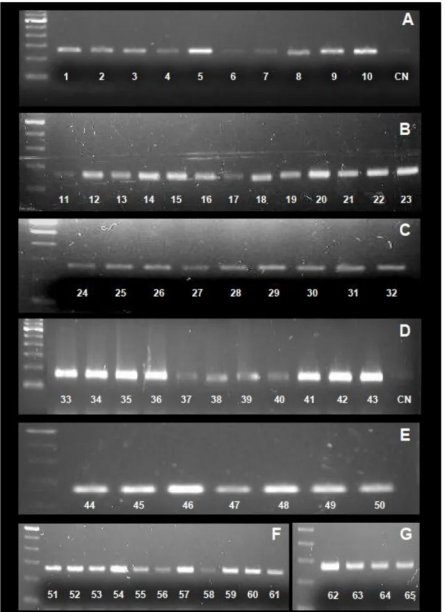 Figura 5: Padrão eletroforético do DNA amplificado do gene da proteína β-globina obtido após PCR 