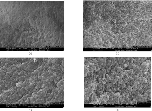 Figura 2. Micrografias de microscopia eletrônica de varredura dos copolímeros sintetizados com misturas TOL/EHEPA no sistema 1: a) 60/40;