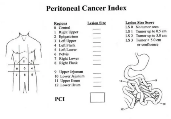 Fig. 1 – Índice de Carcinomatose Peritoneal (PCI) de Sugarbaker. (16) 