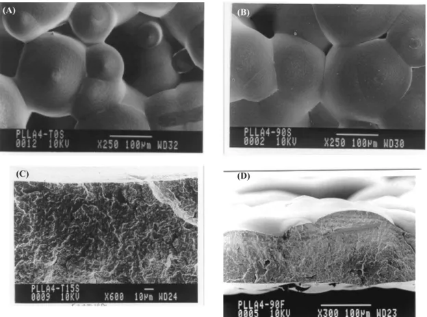 Figura 8. Microscopia eletrônica de varredura de membranas de PLLA: a) da superfície, antes da degradação; b) da superfície após 90 dias de degradação;