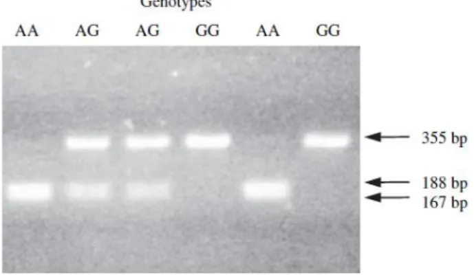 Figure 1.3 – Genotyping the g.17924A˃G polymorphism. The DNA digested with the  restriction  enzyme  MscI  revealed  the  genotypes  g.17924AA,  17924AG,  17924GG