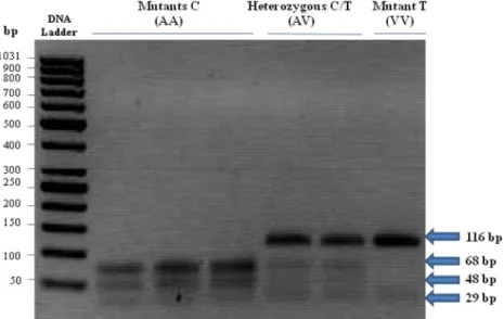 Figure  1.5  –  Genotyping  of  SCD  at  the  878  bp  polymorphic  position.  Representative  result of all the samples analyzed