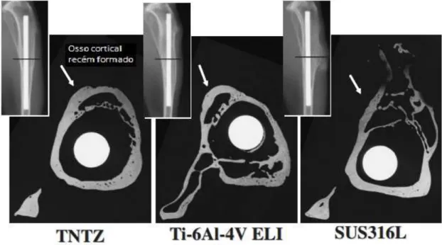 Figura 14. Imagem do corte da seção transversal da tíbia em 24 semanas após  o implante (Niinomi et al., 2008)
