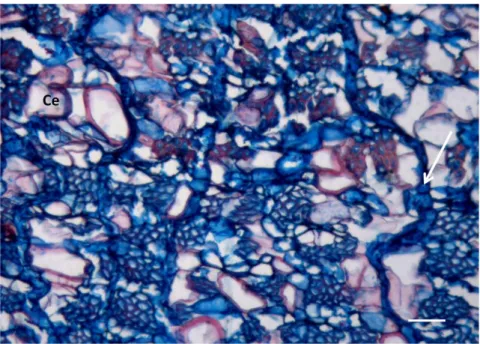Figura 20 – Floema colapsado de E. nitens. Raio distorcido (seta) e células expandidas (Ce)