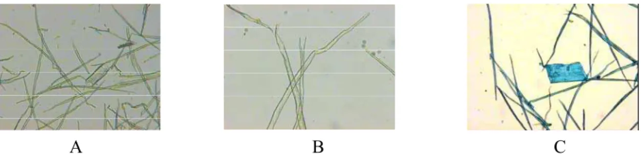 Figura  1  -  Elementos  dissociados  da  madeira: A  -  Acacia  melanoxylon  -  diferentes  tipos  de  células:  fibras  liberiformes, elemento de vaso
