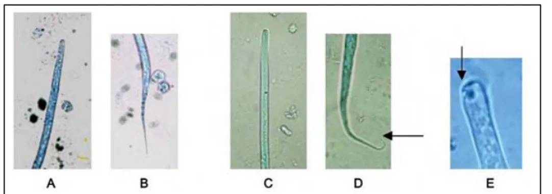 Figura  5  –  Observação  ao  MO  de  características  morfológicas  diferenciadoras  entre  as  microfilárias de D
