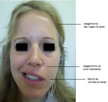 Figura 9- PFP [Adaptado de (24)] 